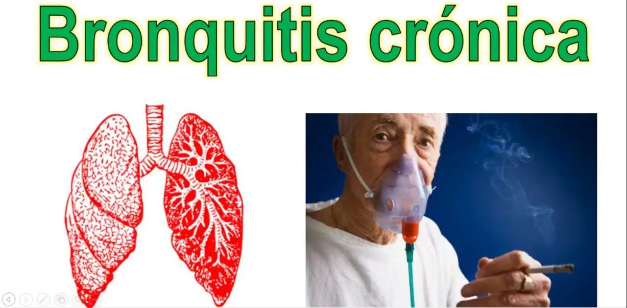 Síntomas de bronquitis Prevención y Tratamiento 2020