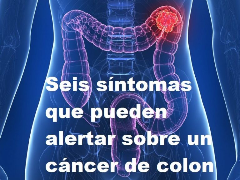 Síntomas De Cáncer De Colon ⊛ ¡prevención Y Tratamiento 2020