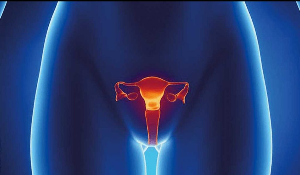 sintomas cancer de cuello utero