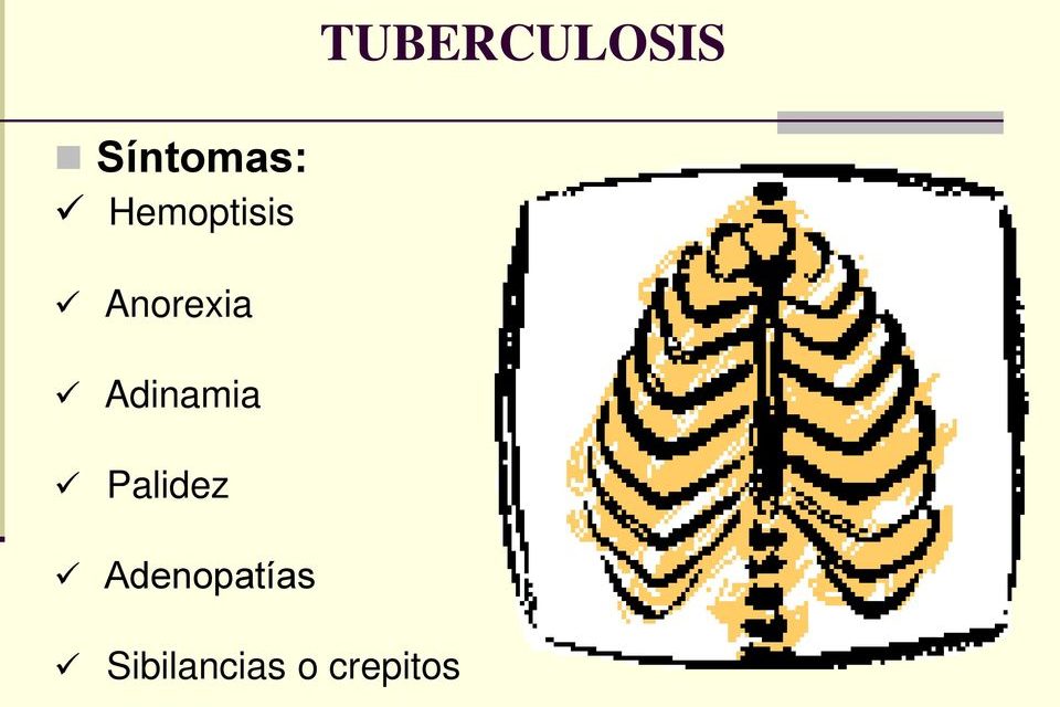 sintomas de infeccion tuberculosis latente