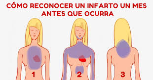 sintomas de infarto portugues