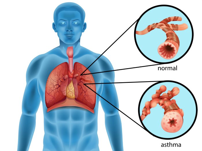 sintomas asma cansancio