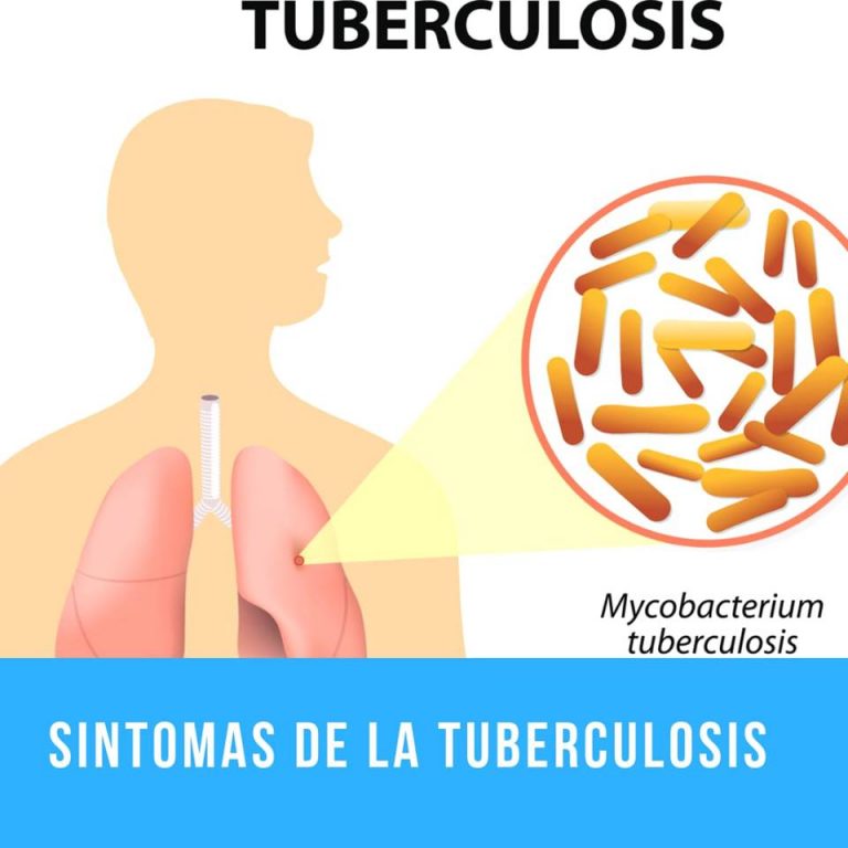 Síntomas Tuberculosis ⊛ ¡prevención Y Tratamiento 2020